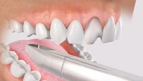 成人能牙齿再生吗视频,探索再生科技新篇章