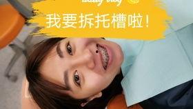 成人正畸直播视频,跟随专家见证牙齿矫正全过程