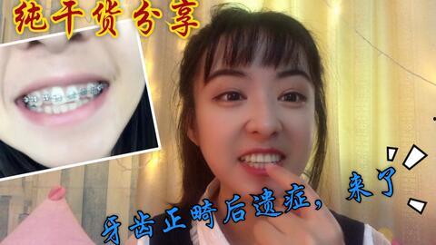 成人正畸直播视频,跟随专家见证牙齿矫正全过程