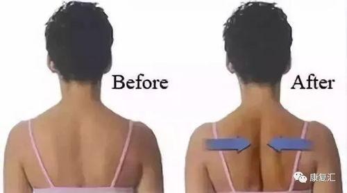 如何矫正成人高低肩视频,轻松改善体态，重拾自信