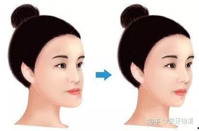 如何矫正成人高低肩视频,轻松改善体态，重拾自信