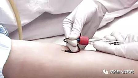 成人股静脉采血操作视频,视频教学指南